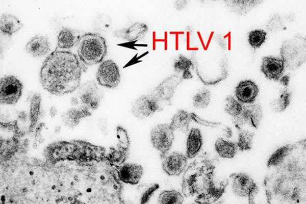 htlv-1