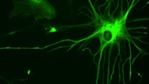 immunofluorescenza