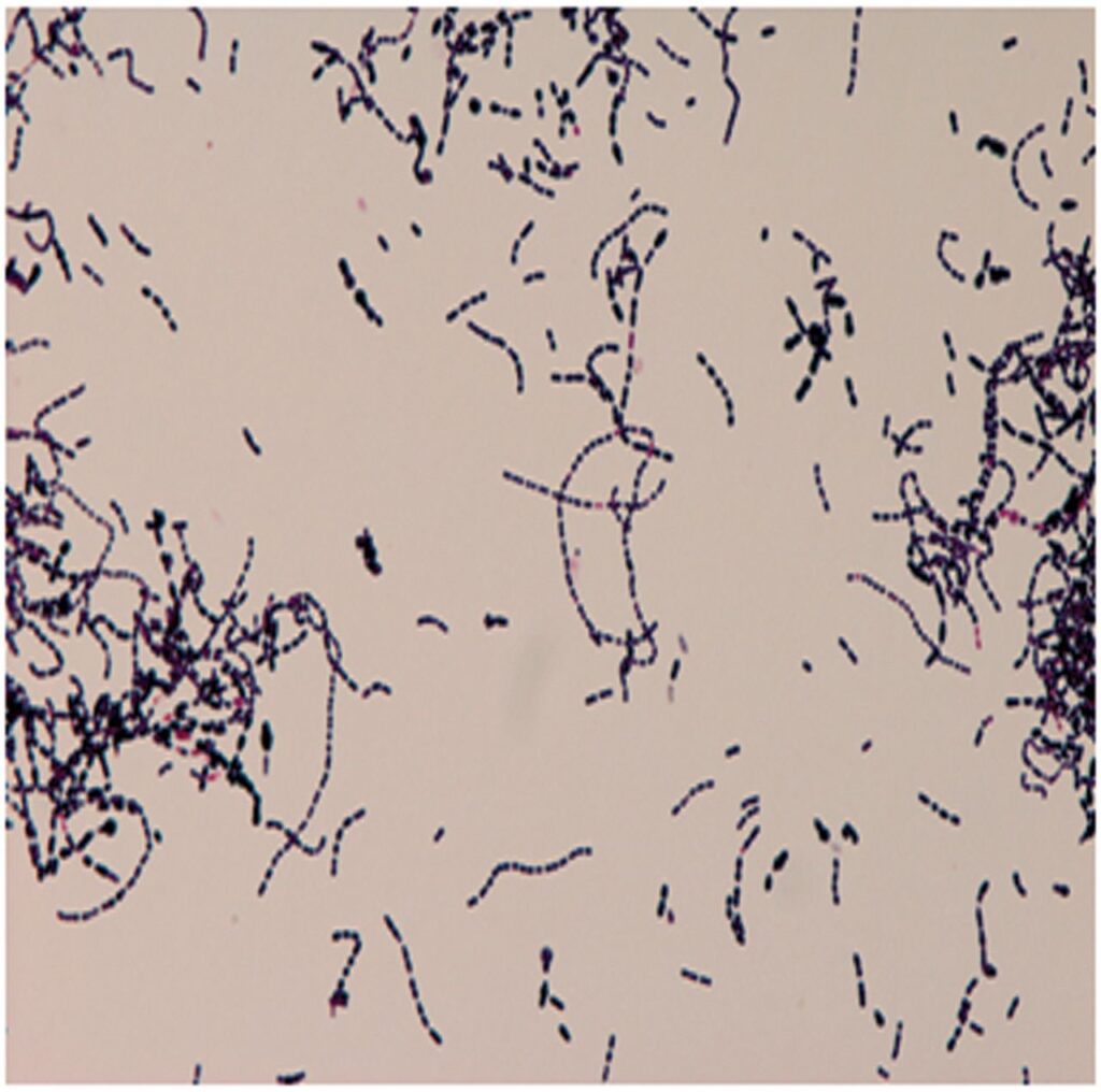 Streptococcus bovis al microscopio ottico