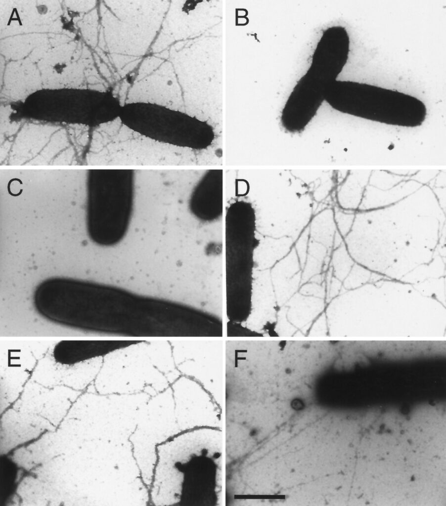 Eikenella corrodens al microscopio ottico Eikenella corrodens

