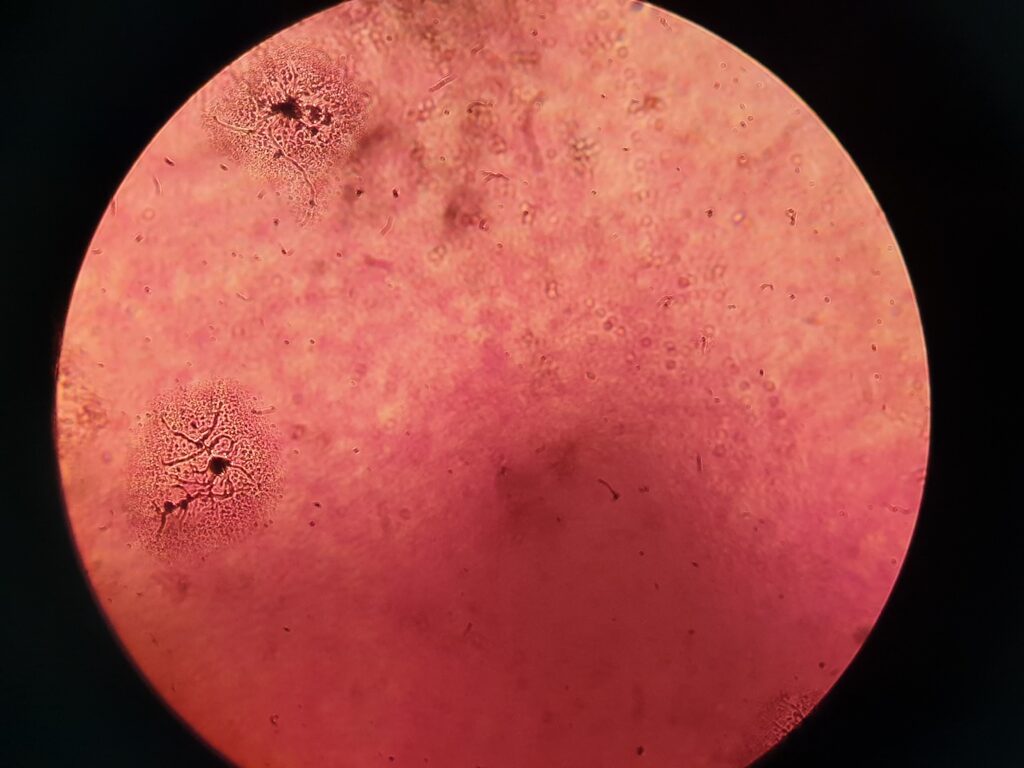 Pseudomonas aeruginosa, uno dei batteri coinvolti nella rhizoremediation.