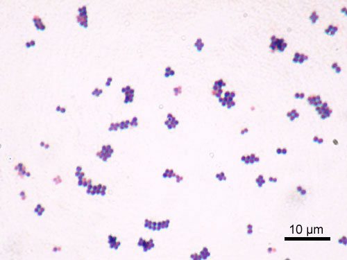 S. aureus Baird Parker Agar Base
