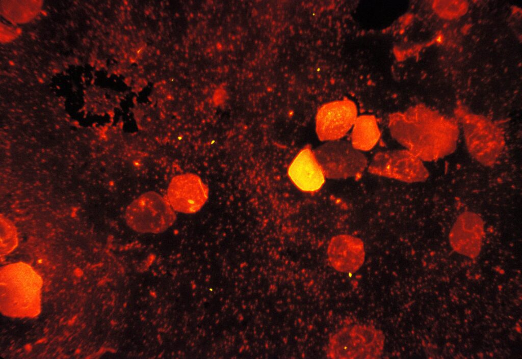Mycobacterium tuberculosis, uno dei batteri coinvolti nella rhizoremediation.