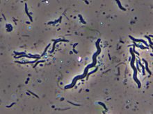 Aspetto microscopico dello Spirillum minus