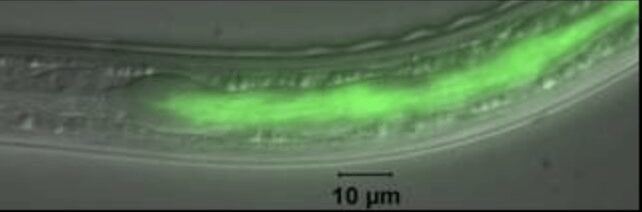 P. luminescens nell'intestino del nematode Heterorhabditis bacteriophora