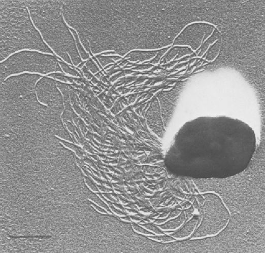 Micrografia elettronica di Pyrococcus furiosus