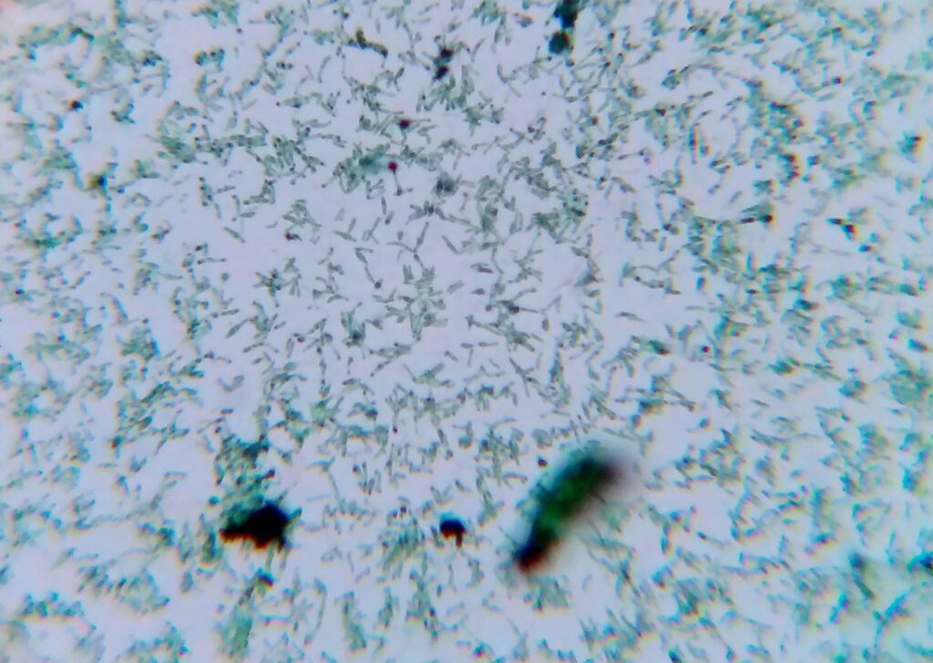 Batterio Corynebacterium diphtheriae evidenziato tramite colorazione di Albert