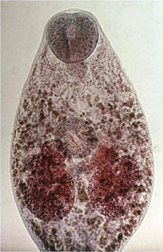 Figura 1 – Verme adulto di N. salmincola
