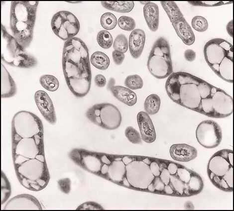 Immagine al microscopio elettronico del lievito oleaginoso Rhodococcus opacus in grado di produrre bioprodotti come i lipidi.