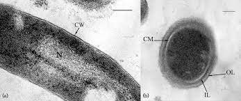 Sezioni sottili di cellule di M.arcticum; a) cellula a forma di bastoncello (b) cellula simile ad una cisti. CM, membrana citoplasmatica; CW, parete cellulare; IL, strato interno della parete cellulare; N, nucleoide; OL, strato esterno della parete cellulare. 