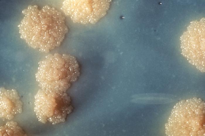 Mycobacterium tubercolosis 