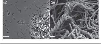 Micrografia a contrasto di fase- a) mostra singole cellule,  filamenti e una parte di un aggregato di M. thermaggregan  ; (b)  mostra filamenti cellulari intrecciati e filamenti costituiti da barre