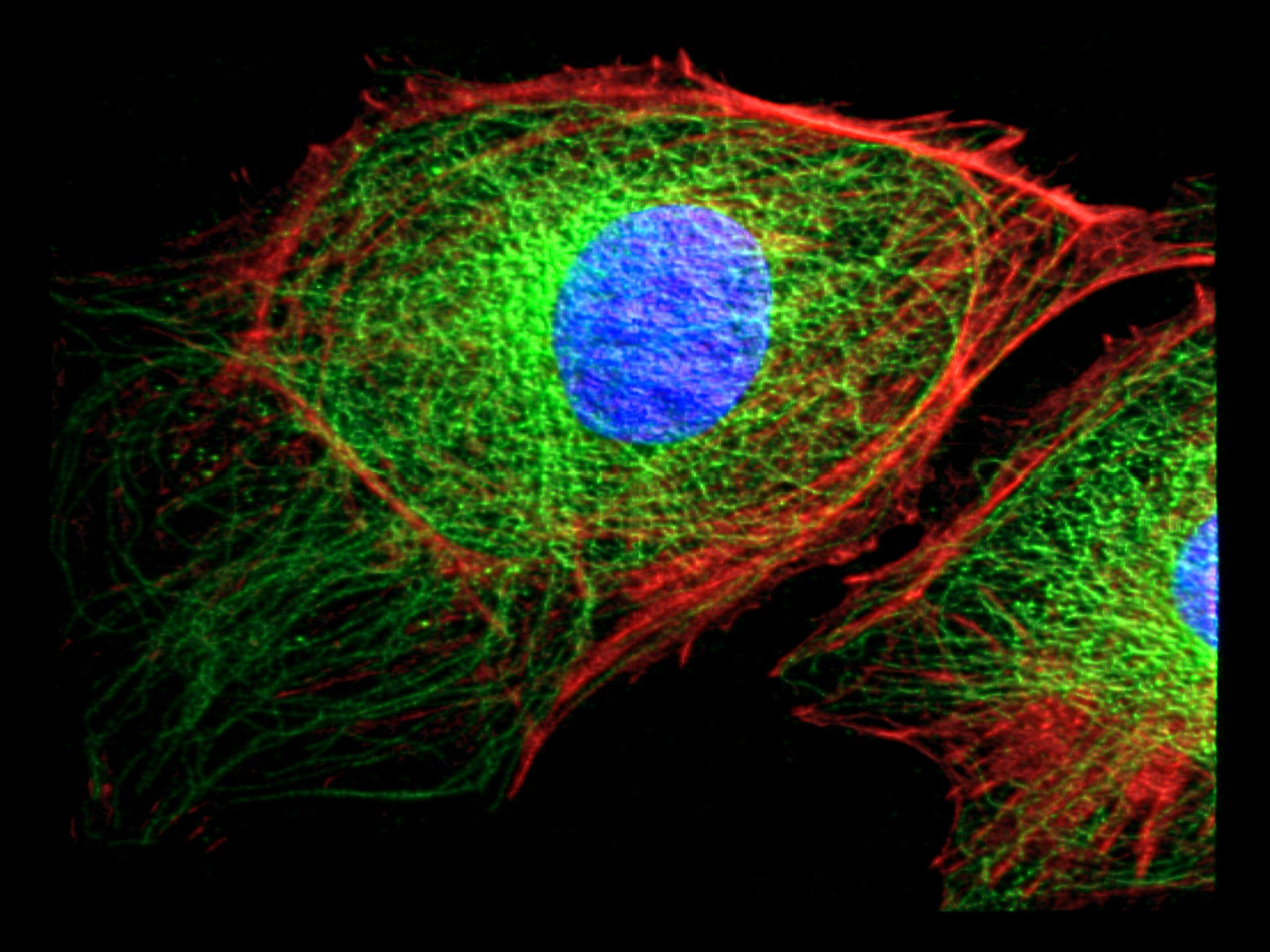 Клетка метка. Цитоскелет клетки флуоресцентная микроскопия. Цитоскелет микрофиламенты. Цитоскелет флуоресценция. Цитоскелет микрофотография.