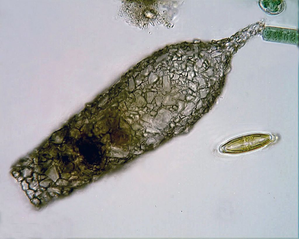 Ameba diffugia al microscopio
