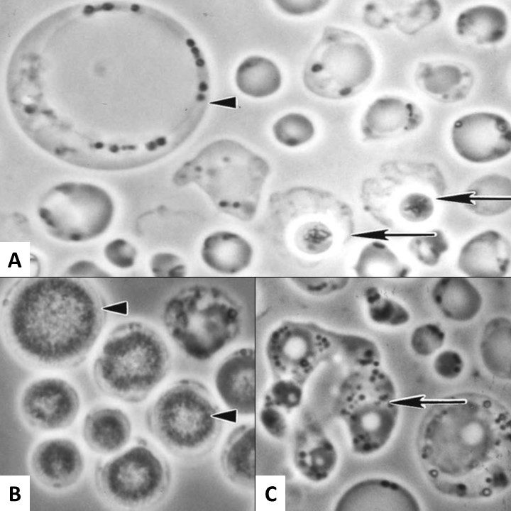 Caratteristiche morfologiche delle forme granulari, ameboidi e cistiche di Blastocystis sp. in coltura, osservate al microscopio a contrasto di fase