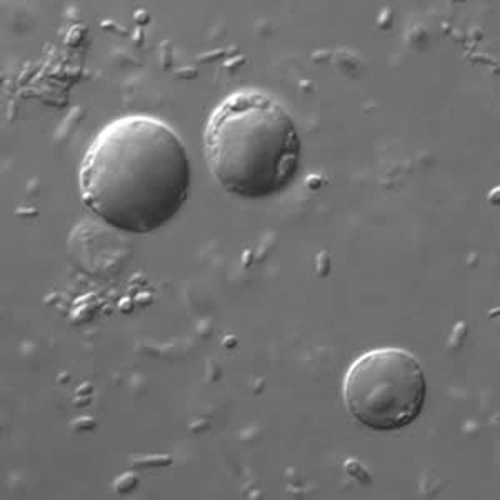 Forme vacuolari di Blastocystis sp. in coltura, osservate al microscopio a contrasto di fase