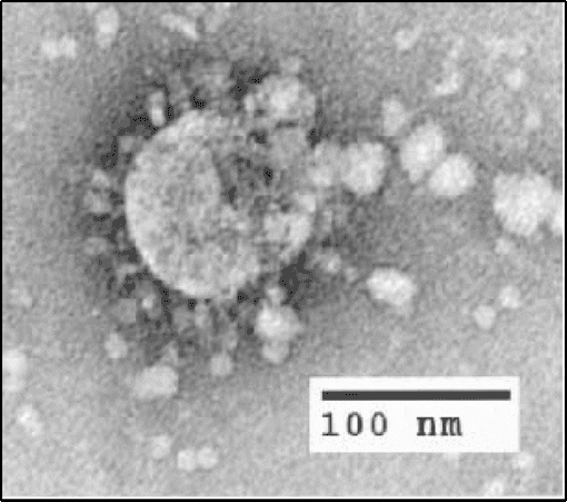 The virus Sars-Cov-1 visualized at the electric or transmission microscope