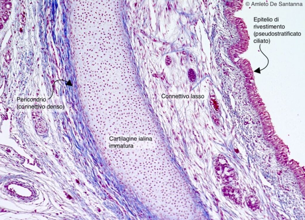 Tessuto cartilagineo: cartilagine ialina