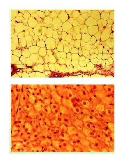 Tessuto connettivo adiposo bianco (sopra) e tessuto adiposo bruno (sotto)
