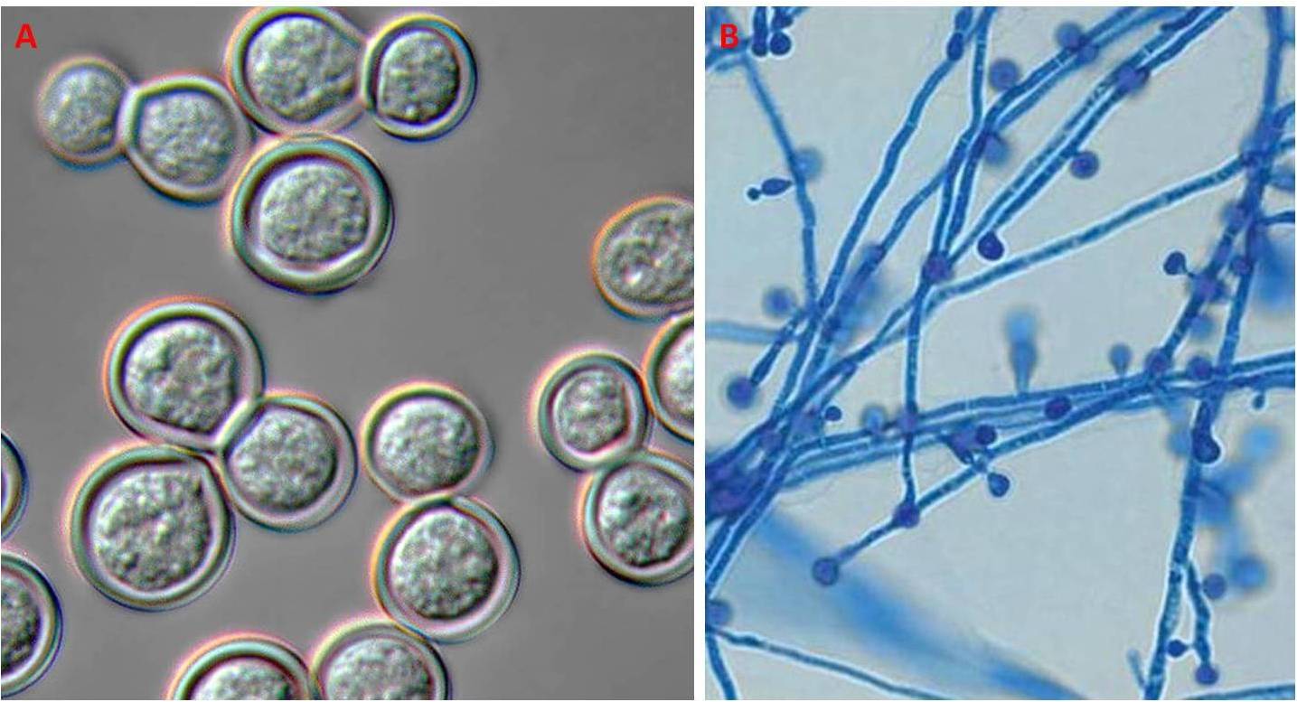 Figura 1 – B. dermatitidis sotto forma di lievito (A) e muffa (B) provenienti rispettivamente da una coltura su agar sangue a 37° C e da una coltura su agar Sabouraud a 30° C
