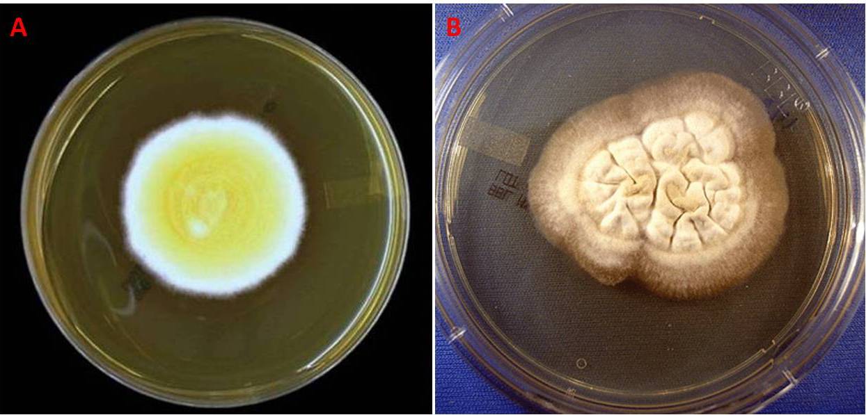 Figura 3 – Colonie di B. dermatitidis su agar Sabouraud, dall’aspetto soffice (A) e glabro (B)