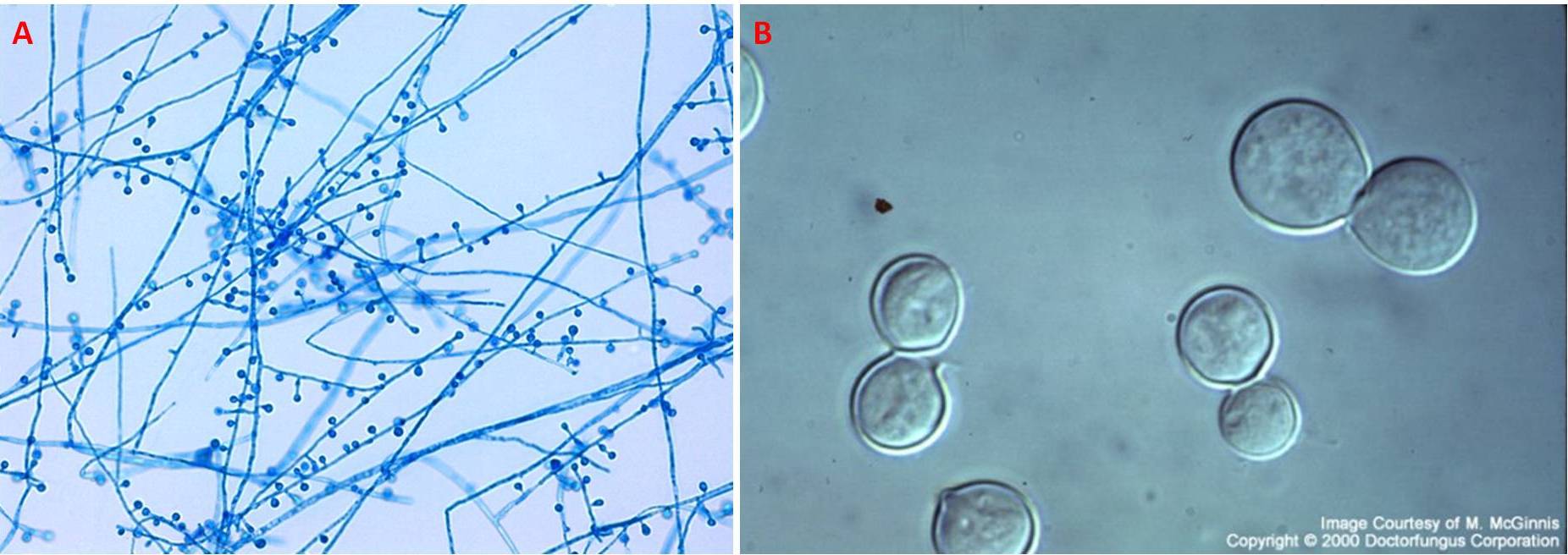Figura 4 – Microscopia delle due forme di crescita del B. dermatitidis, muffa (A) e lievito (B). Nell’immagine A i conidi attaccati ai conidiofori laterali creano una struttura che ricorda una leccalecca  