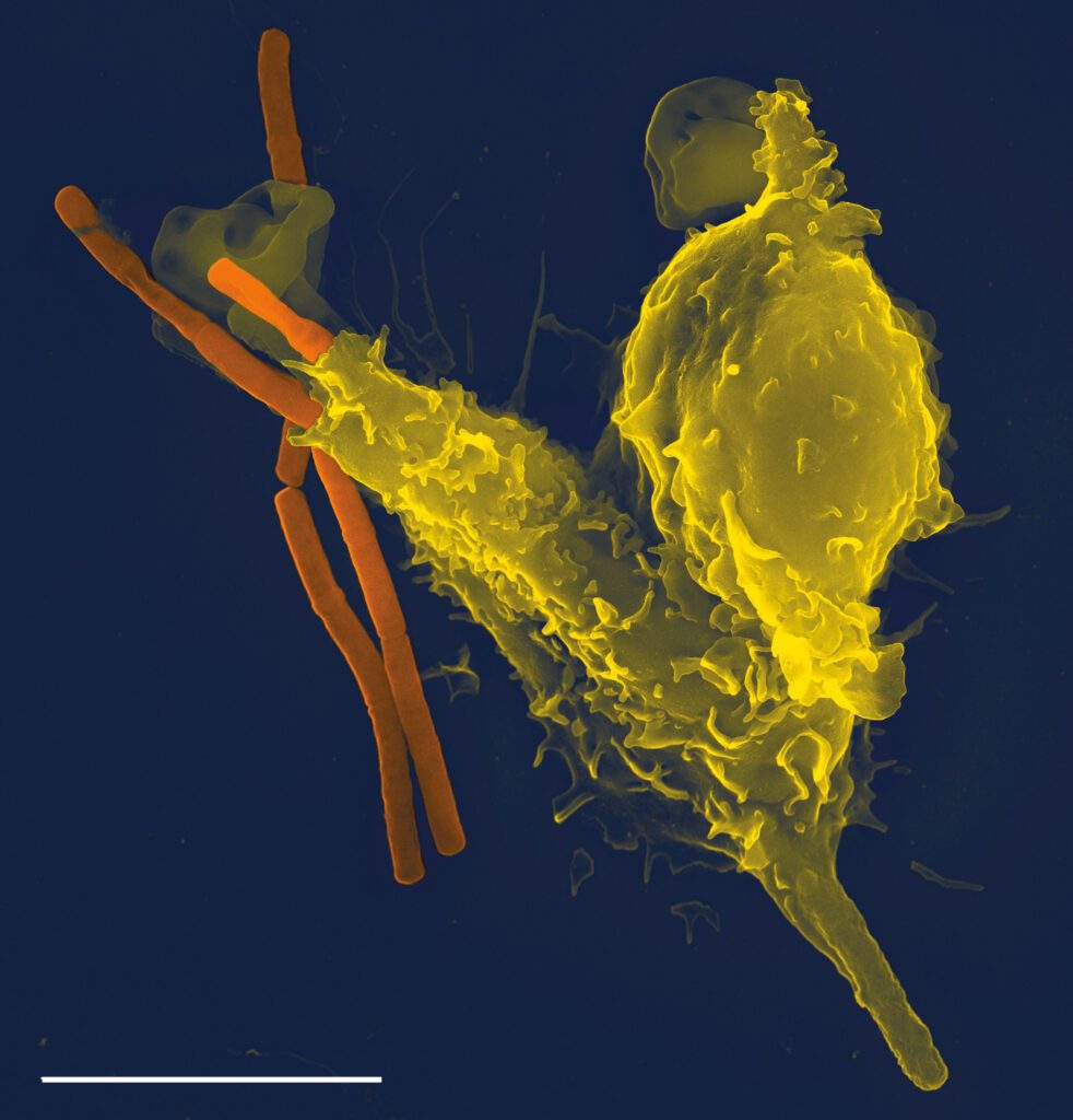 Granulocita neutrofilo mentre fagocita un Bacillus anthracis. Microscopio elettronico a scansione. Achille Scalvo ha progettato un siero per contrastare la patologia causata da questo batterio. 