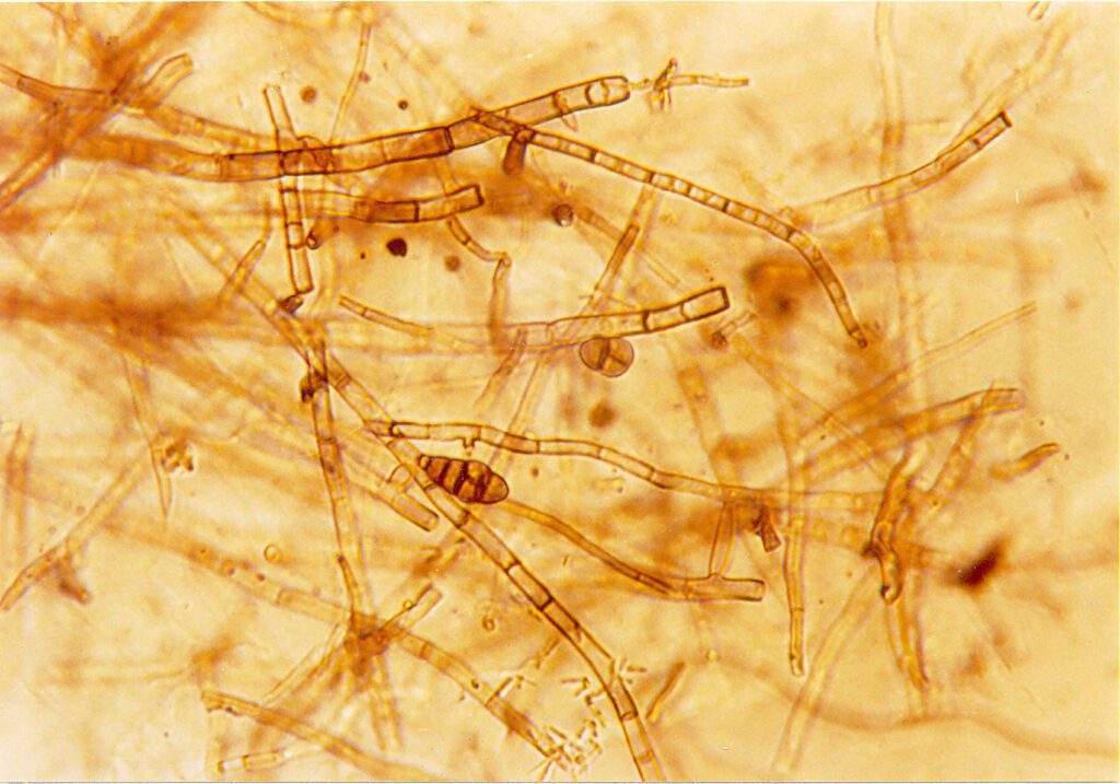 Osservazione al microscopio delle ife fungine