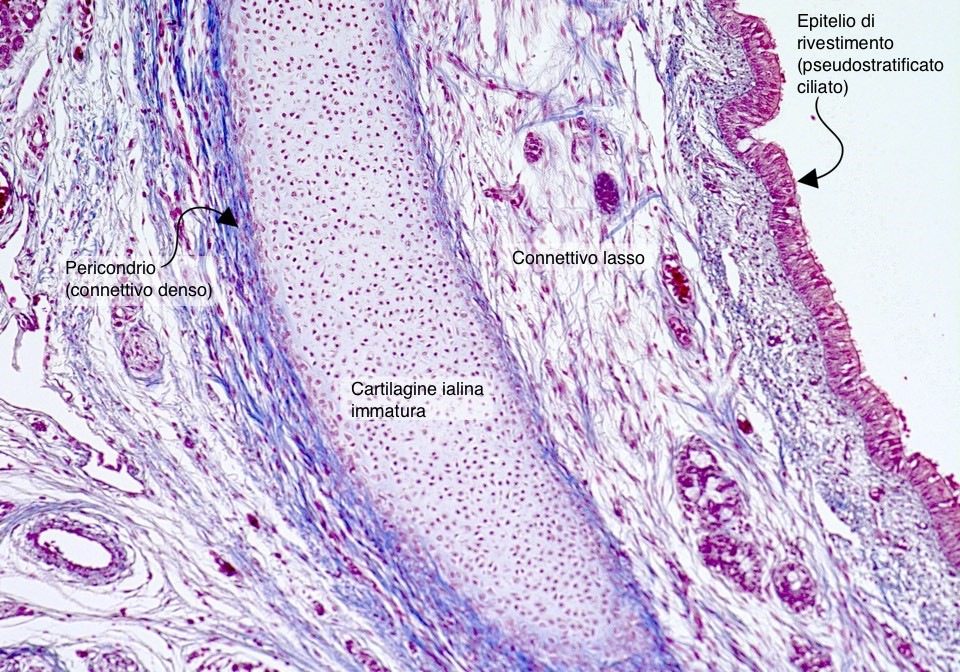 tessuto connettivo: Cartilagine ialina
