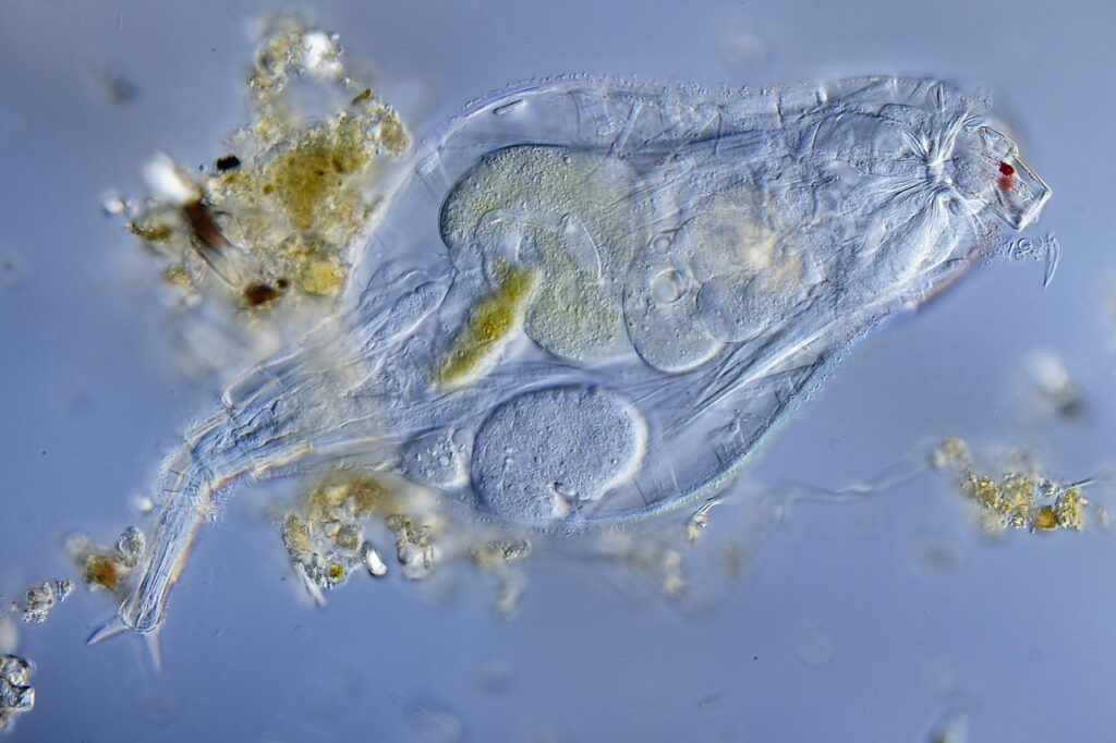 Rotifer, unknown species