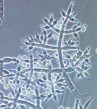 Trichoderma harzianum, tipico endofita delle pianta