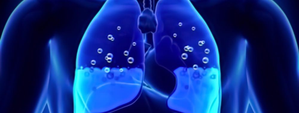L'edema polmonare si forma a causa di un eccesso di liquidi nei polmoni sistema respiratorio