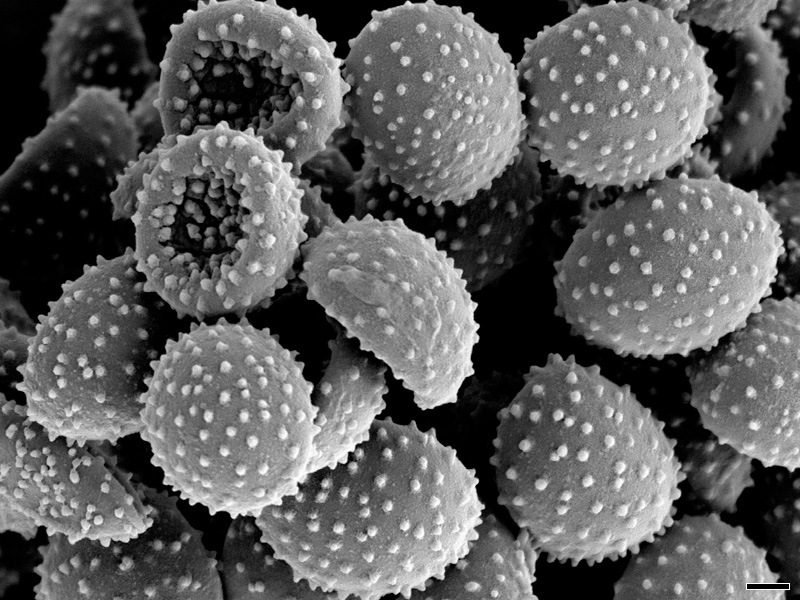 Spore U. nuda con microscopio SEM, scala 1 μm (Fonte: Smut Fungi of Australia)