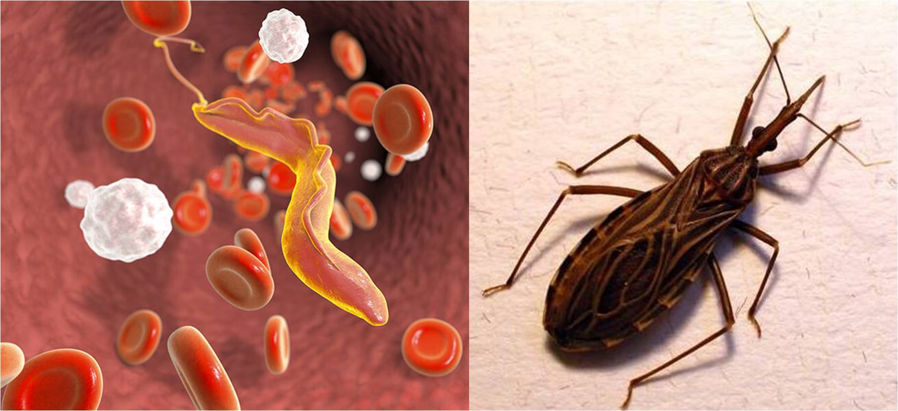 Trypanosoma cruzi