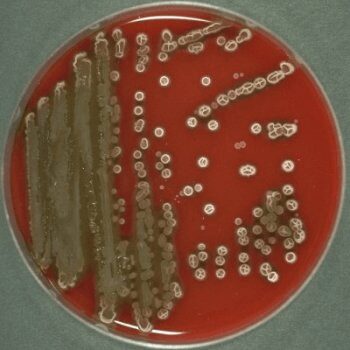 Figure 2 - Bacillus subtilis in blood agar - [Credit: University of Copenhagen, Denmark]
