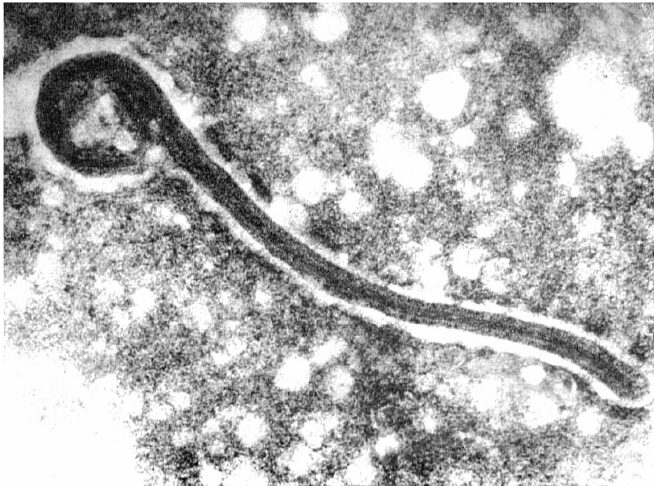 Figura 2 – Prima immagine del Marburg virus, anno 1967 [Credits: University of Marburg, Germany]