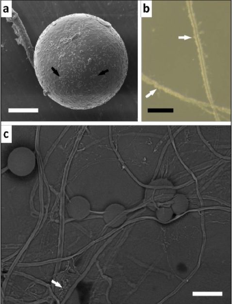 Rhizophagus irregularis con Pseudomonas Flourescences visto con microscopio SEM (Fonte: Oksana Shtark et al.)