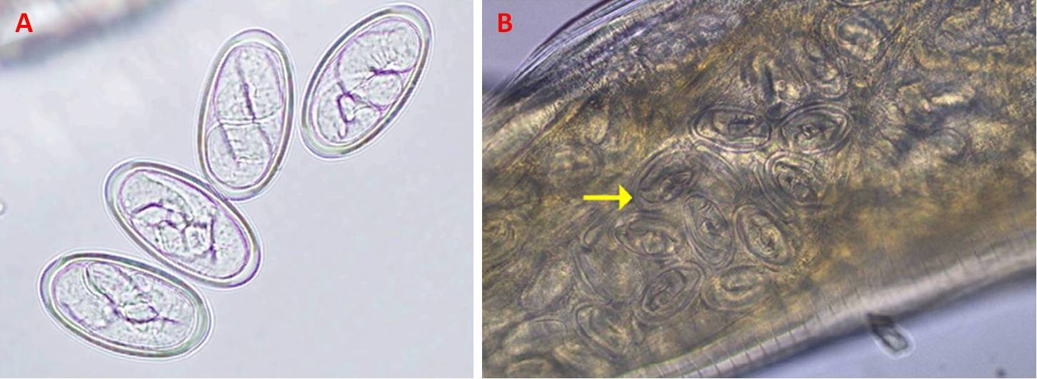 Figura 2 – Uova embrionate di G. pulchrum. Nell’immagine B si trovano all’interno della vagina