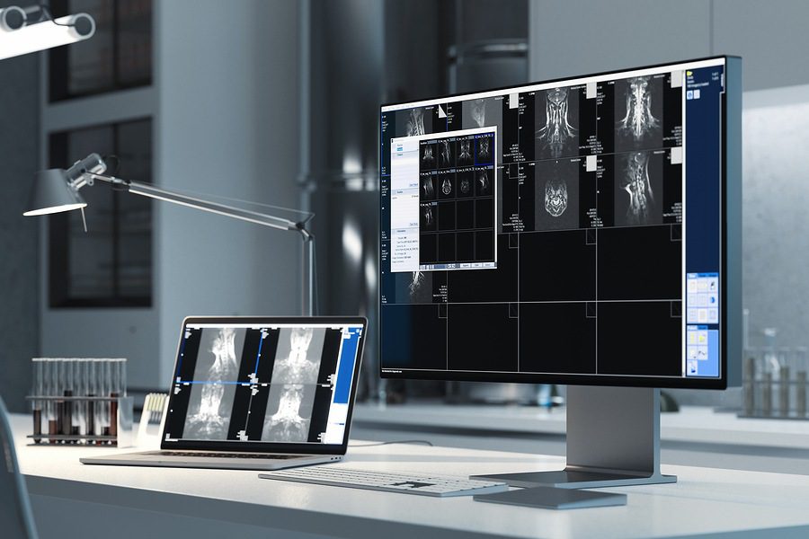 Cancer screening by medical imaging