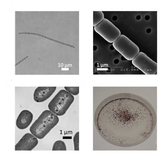 Figura 5 - Morfologia di Pseudanabaena sp. NIES-4403 e distribuzione su piastra - [Credit: Yamamoto et al., 2021] 