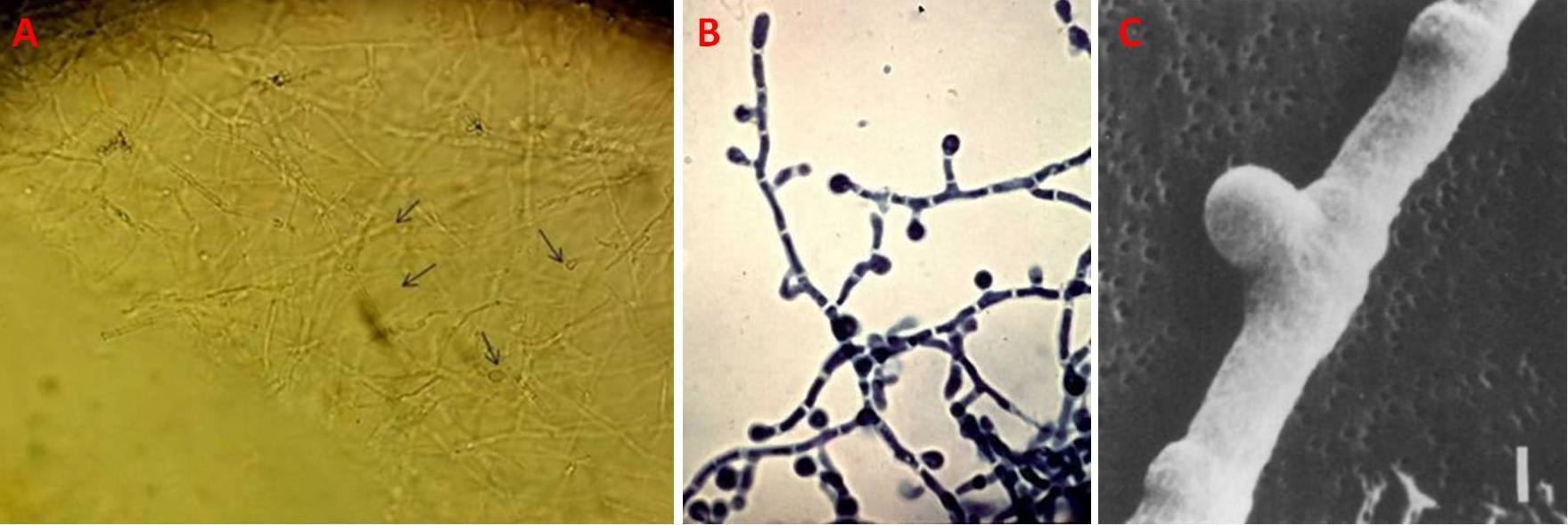 Figura 3 – Forma miceliale di P. brasiliensis. Nell’immagine A le frecce indicano i conidi; l’immagine C mostra un conidio nella fase precoce di sviluppo di un artroconidio intercalare
