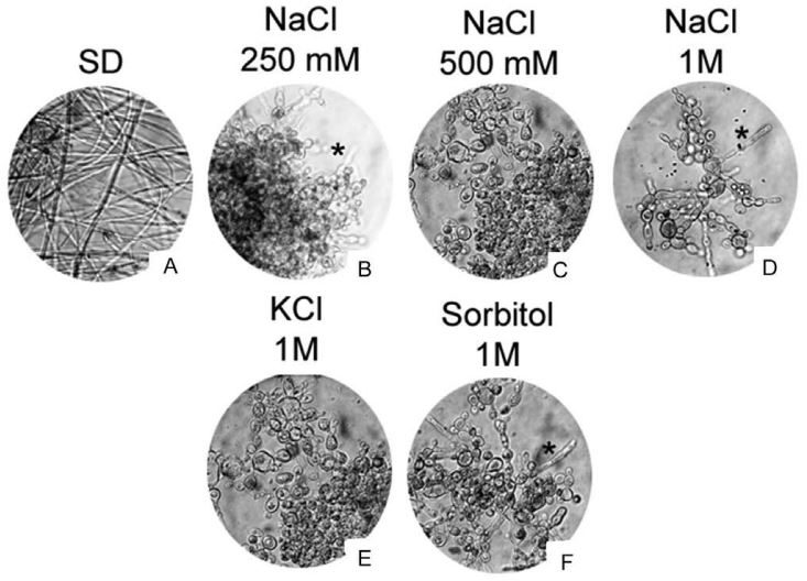 Figura 6 – Le cellule di P. brasiliensis riescono ad effettuare la transizione da lievito a muffa in terreno SD (A), ma tale processo è inibito in presenza di NaCl a varie concentrazioni (B, C, D), di KCl (E) e di sorbitolo (F) 