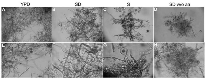 Figura 7 – La crescita delle cellule fungine in terreno SD senza amminoacidi (D, H) mostra un arresto della conversione da lievito a muffa, che non si verifica in terreno YPD (A, E), in SD (B, F) e in SD privo di glucosio (C, G) 