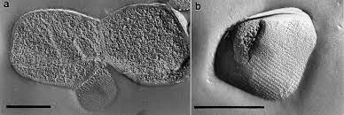 Rappresentazione al microscopio a contrasto di fase di cellule di Ferroglobus placidus. a)cellule di forma irregolarmente coccoide disposte in coppia; b) cellule di forma triangolare 