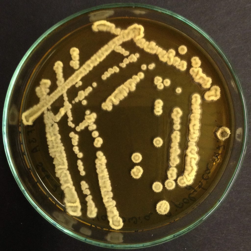 Piastra di Petri contenente il terreno Wort agar su cui sono cresciute colonie di Yarrowia lipolytica.