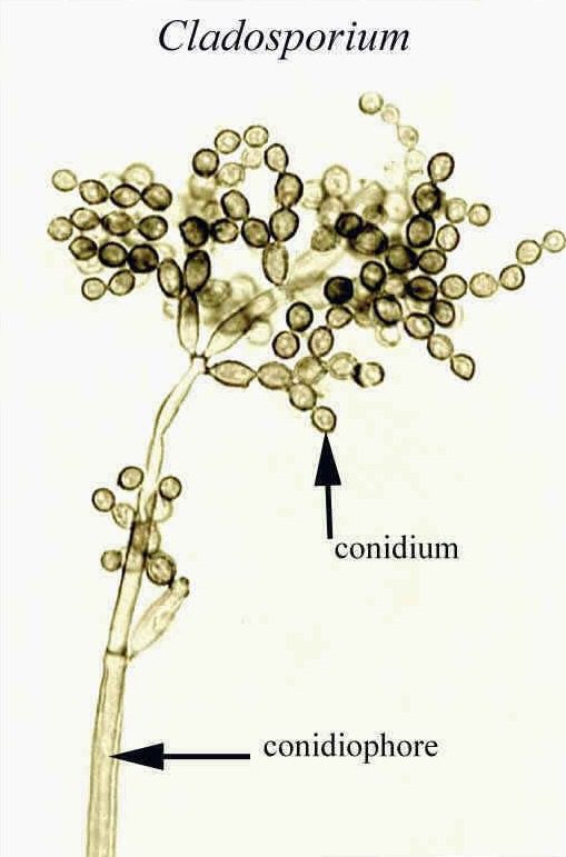 Cladosporium sphaerospermum