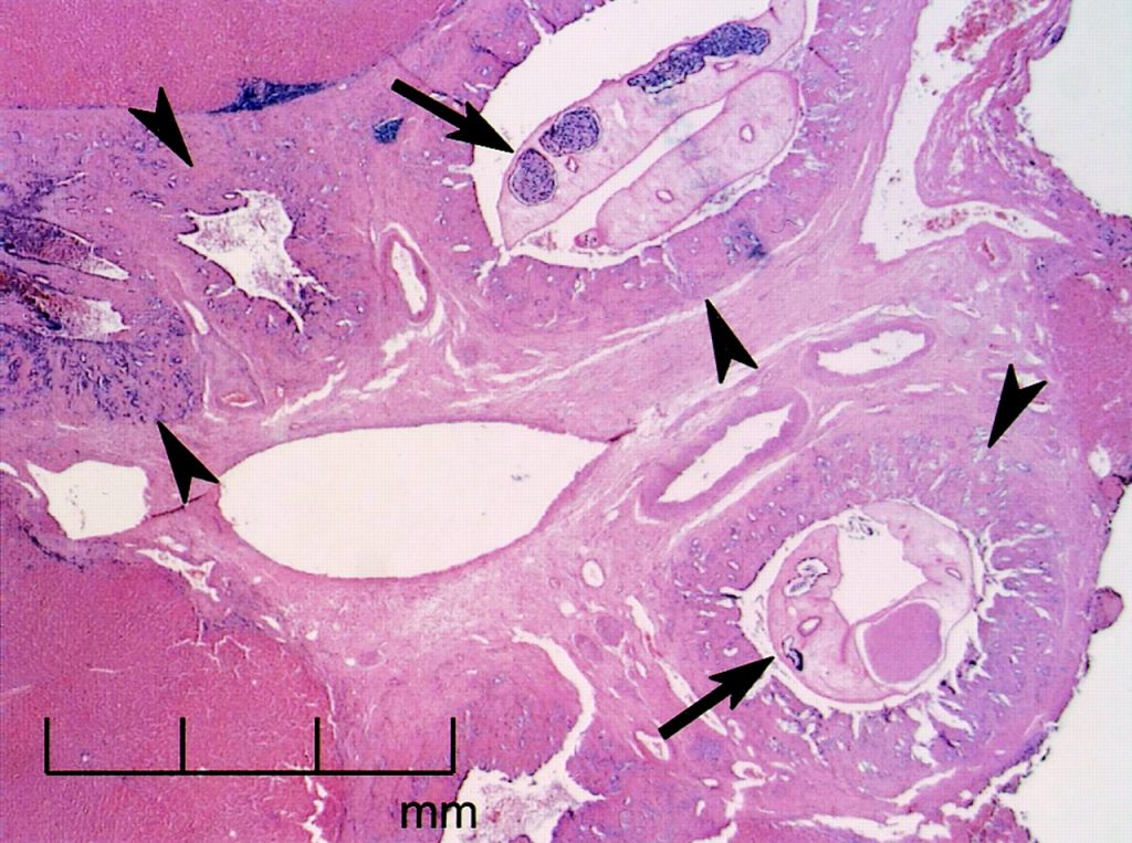 Figura 7 – Biopsia epatica colorata con Ematossilina-Eosina, che mostra la presenza di vermi adulti all’interno dei dotti biliari dilatati (frecce), iperplasia dell’epitelio biliare (punte di frecce) e fibrosi periduttale