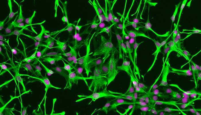 igura 2- Le cellule della microglia hanno prevalentemente una forma ameboide e sono di grandi dimensioni. Hanno grande capacità fagocitica e svolgono un importante ruolo nel combattere le infezioni. 