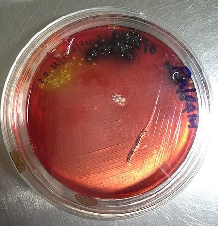 PALCAM agar con stafilococco e Listeria