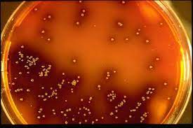 L. monocytogenes su palmcam agar